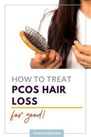 pcos hair loss everything you need to