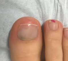 acrylic nails on toes
