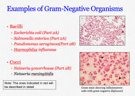 gram staining organisms flashcards