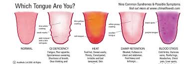 Stick Out Your Tongue Understanding Chinese Tongue Diagnosis