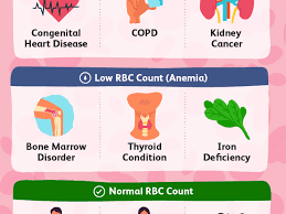 Understanding The Red Blood Cell Rbc Count