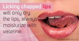 vaseline on chapped lips