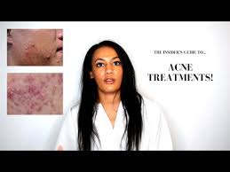 acne skin routine for acne e skin