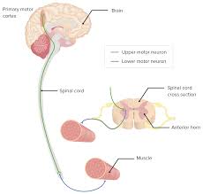 motor neuron lesions concise cal