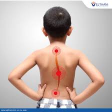 scoliosis surgery and treatment in