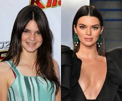 Maybe you would like to learn more about one of these? Kendall Jenner So Hat Sich Das Model Verandert