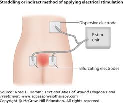 Electrical Stimulation Text And Atlas Of Wound Diagnosis