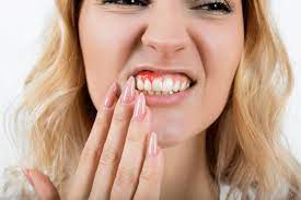 swollen gums treatment in indian trail