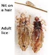 head lice