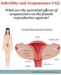 fertility acupuncture and reive