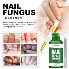nail fungal treatment antifungal 30ml