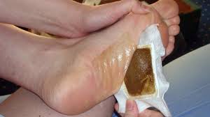 how to make detox foot pads at home to