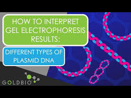 interpret gel electropsis results