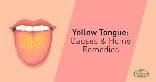 yellow tongue