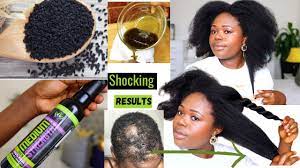 black seed oil for mive hair growth