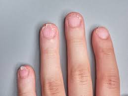 brittle nails causes and care guide