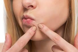 get rid of lip pimples swollen big