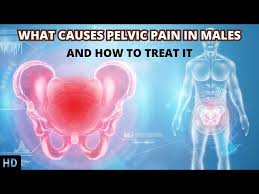 decoding pelvic pain in males