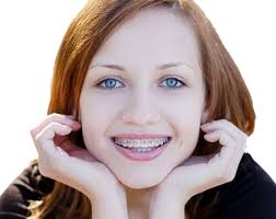 If you have children age 18 or younger, insurance companies must offer an option to purchase dental insurance that meets the criteria of the affordable care act (aca) when you are. Do Your Kids Need Orthodontic Treatments Like Braces Easydentalquotes