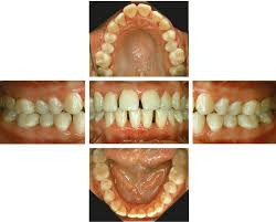 Periodontal Diagnosis In The Context Of The Bsp
