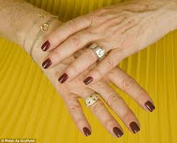 After getting acrylics, edwards says some people may experience a tightening sensation due to the acrylic forming a firm seal over your nails. Why Your Manicure Could Ruin Your Nails For Life Horror Stories Range From Weeping Sores And Bleeding Nail Beds To Skin Cancer Daily Mail Online