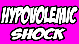 yusriarif  Hypovolemic shock   nursing tutorials   Pinterest     SlideShare Hemorrhagic shock classification