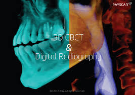 3d cbct digital radiography ray