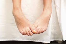 toenail fungus treatment at home