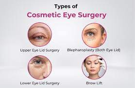 types of eye cosmetic surgery from