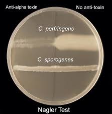 The test is a simple procedure. Nagler Reaction Lecithinase Test Microbe Online