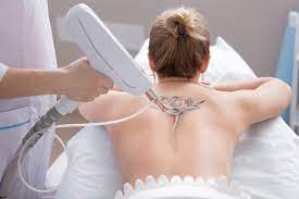 Also, there's little accuracy, and excessive amounts of skin are often removed. Laser Tattoo Removal Bismarck Minot Dickinson Nd Aesthetic Center