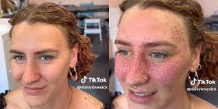 タトゥーで顔にフェイクのそばかすを大量に入れた女性に賛否「信じられない行為」「絶対に後悔する」海外SNSで議論勃発