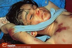 Image result for ‫کودکانی که با جنایت آمریکا بر فراز خلیج فارس پر پر شدند‬‎