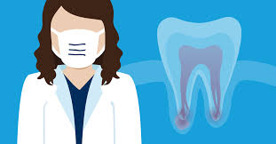 They may be irritated by any and all of the following types of events. Root Canals During Covid 19