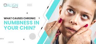 what causes chronic numbness in your chin