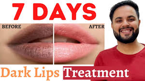 7 days dark lips removal challenge