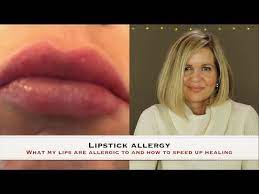 lipstick allergy what i am allergic