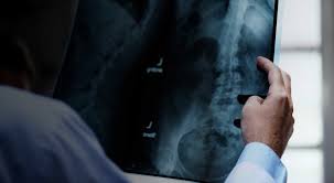Image result for radiology malpractice