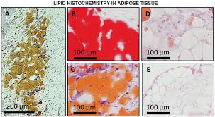 Sudan iv test is used to detect the presence of lipid in a solution. Examples Of Lipid Histochemistry Of Adipose Tissue Carried Out With Download Scientific Diagram
