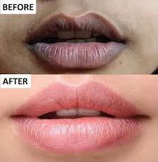 lipzlite lip lightening cream for dark