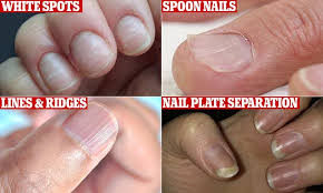 We did not find results for: Australian Experts Reveal Common Nail Problems And What These Say About Your Health Daily Mail Online