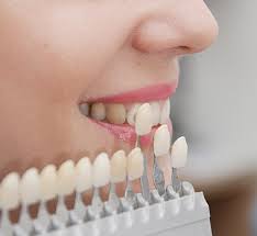 Cosmetic Dentistry Landrum Porcelain Veneers Teeth Whitening