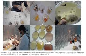Laboratory Based Experimental Study on Microbial Spoilage of Comm