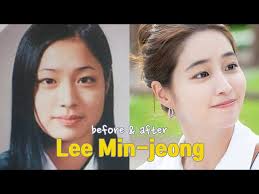 lee min jeong before and after you