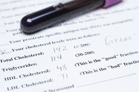 what is total cholesterol and what does