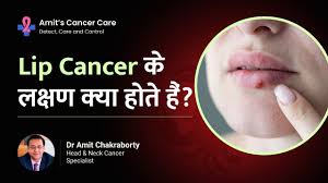 lip cancer causes symptoms diagnosis