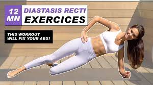 exercises for diastasis recti best 12