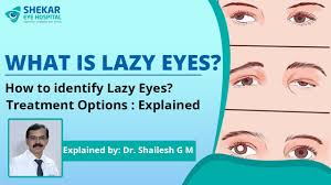 how to fix lazy eyes amblyopia