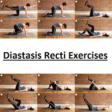 diastasis recti exercises apk