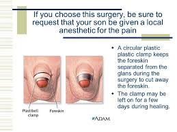 62 Hand Picked Normal Plastibell Circumcision Pictures